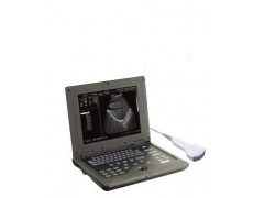 超声诊断仪/笔记本便携式式B超/孕妇胎儿检查/Bchao