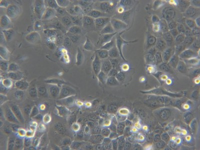 T2 人淋巴母细胞智立中特生物
