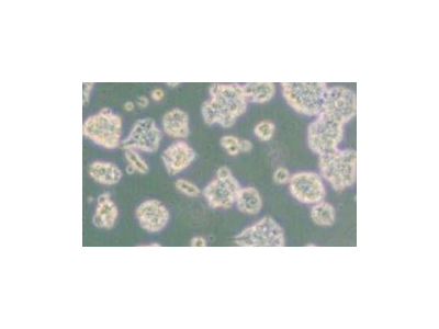 HT22 (小鼠海马神经元细胞) (种属鉴定正确)