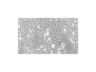 NCI-H2347 (人肺癌细胞) (STR鉴定正确)
